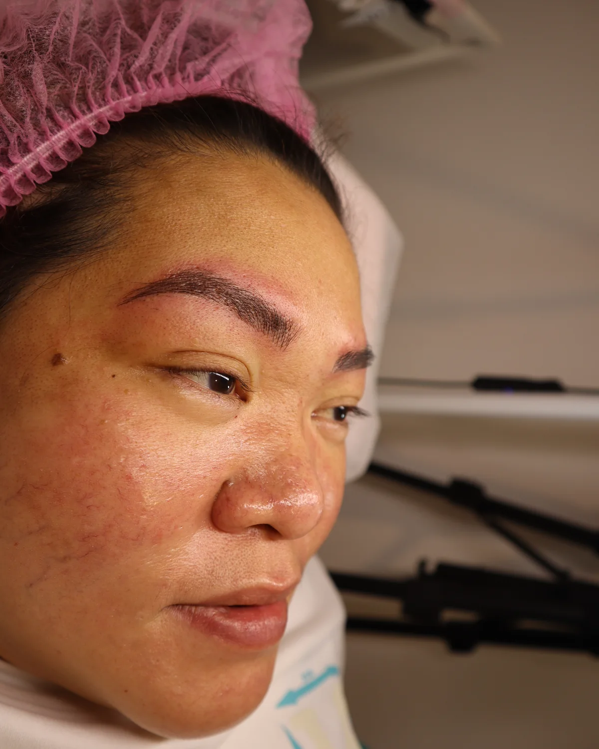 Client result 3 after microblading