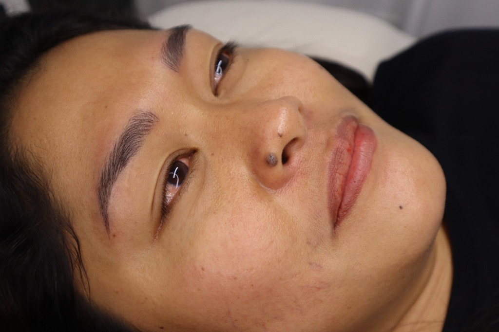 Client result 4 after microblading